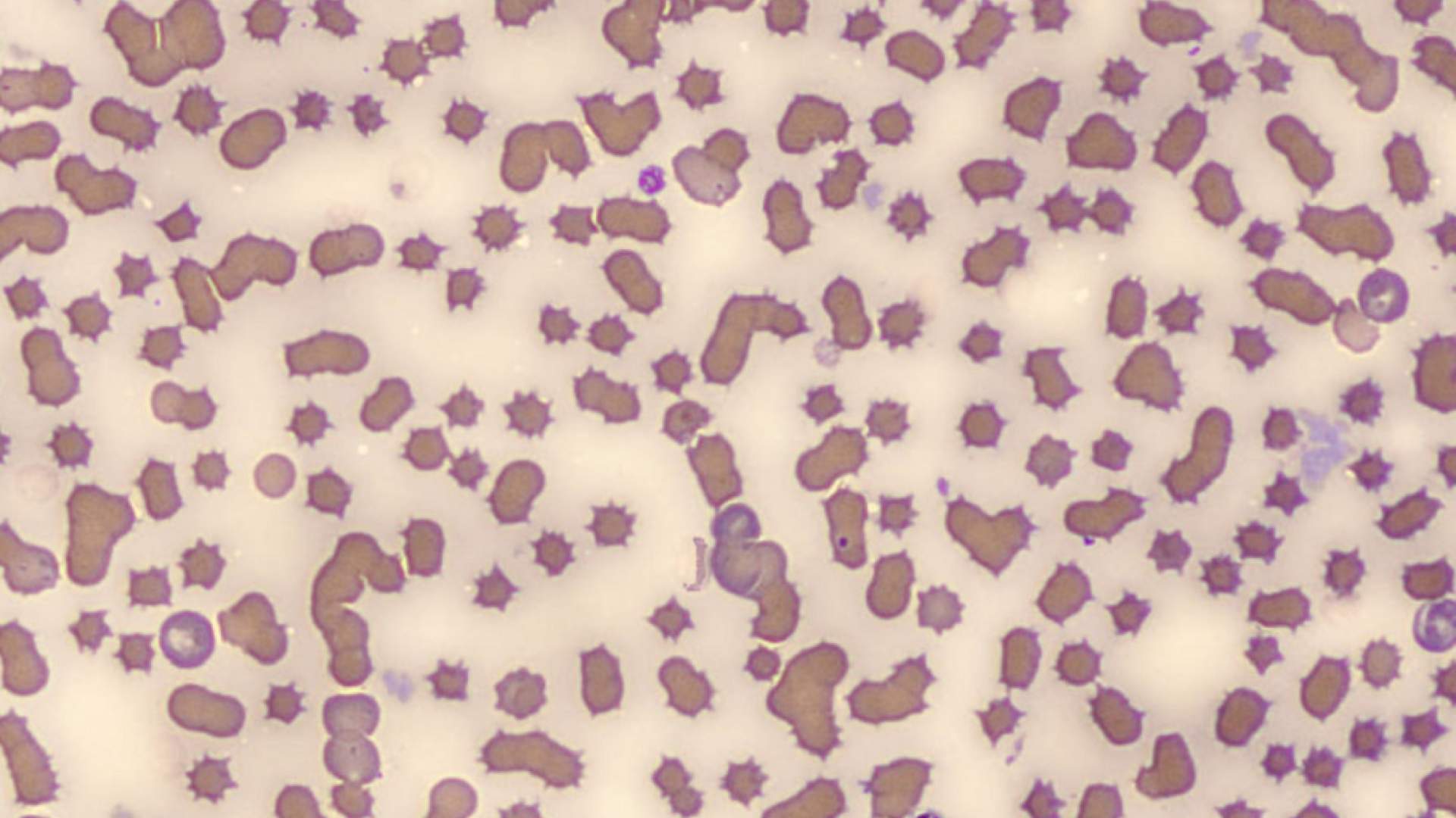 Anemias Felinas con Belén Montoya. Abordaje  diagnóstico completo
