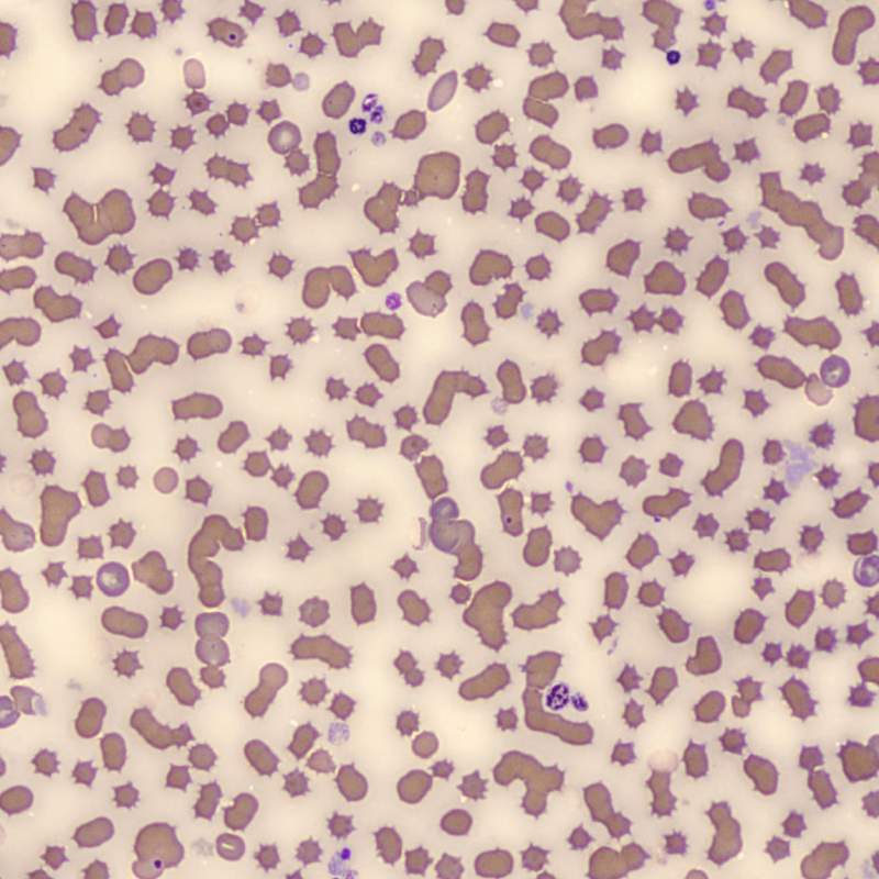 Anemias Felinas con Belén Montoya. Abordaje  diagnóstico completo