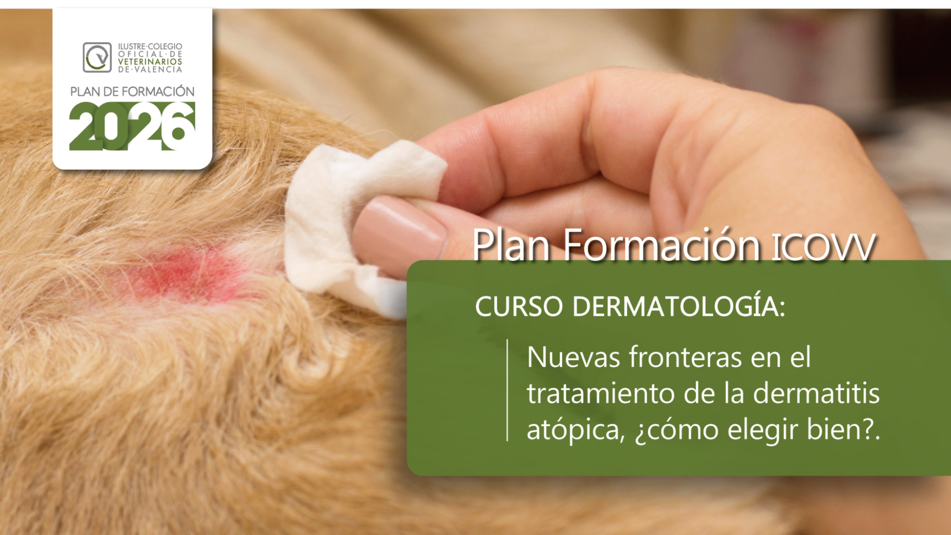 Nuevas fronteras en el tratamiento de la dermatitis atópica, ¿cómo elegir bien?