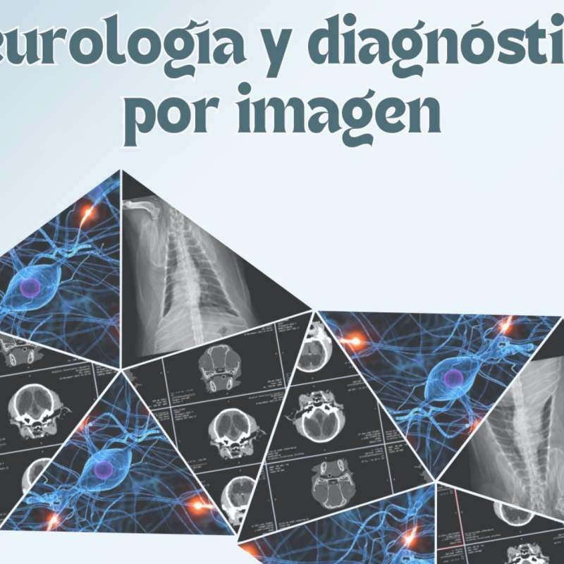 Congreso en Neurología y Diagnóstico por Imagen