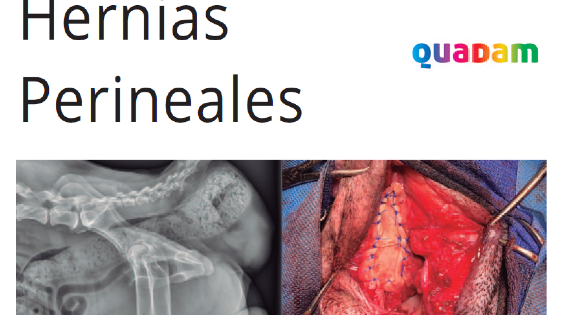 Masterclass Hernias Perineales